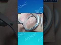 HIFU vs CO2 Laser, perawatan anti-penuaan mana yang Anda sukai?