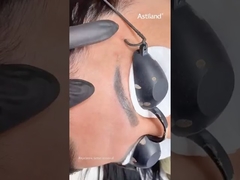 Nd Yag Laser untuk menghilangkan tato alis #ndyaglaser #tattooremovallaser #beautymachine #laserclinic