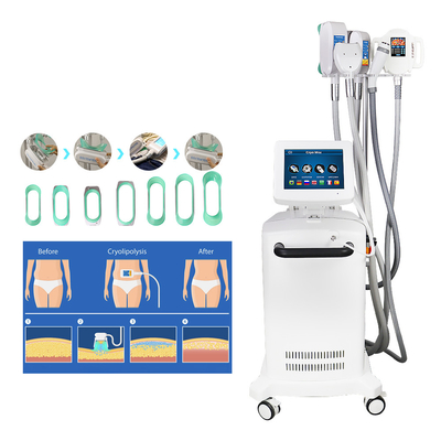Mesin Pelangsing Cryolipolysis Patung Pendingin Untuk Pengurangan Lemak